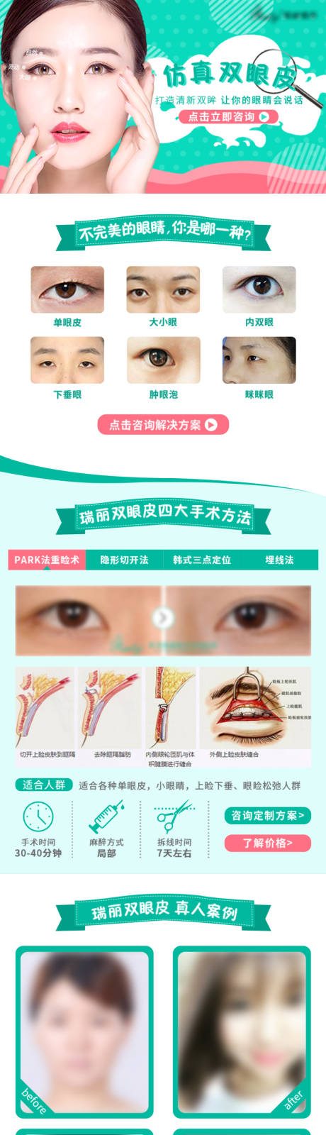 源文件下载【整形医美双眼皮详情页专题页】编号：99140008025673200
