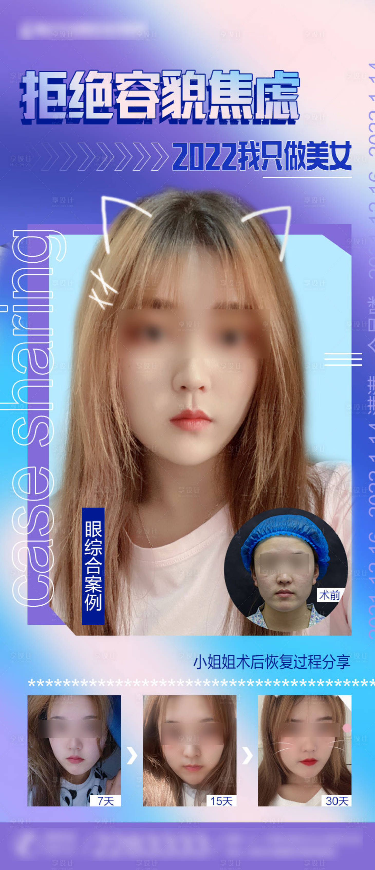 源文件下載【眼綜合案例】編號：96260008254761809
