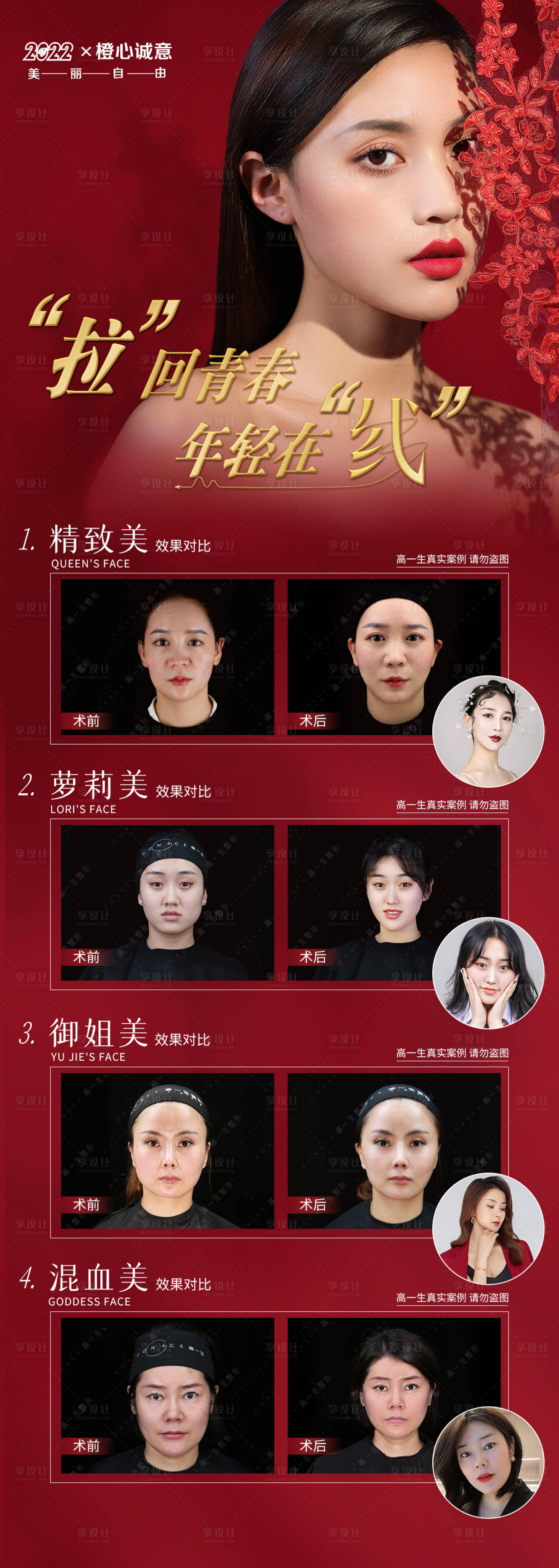 源文件下载【微整案例集人物长图海报】编号：14030008116506145