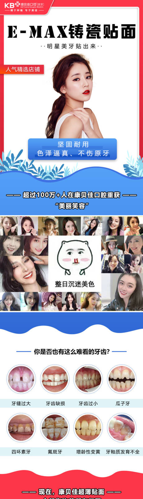 源文件下载【E-MAX铸瓷贴面详情页】编号：71960008478897777