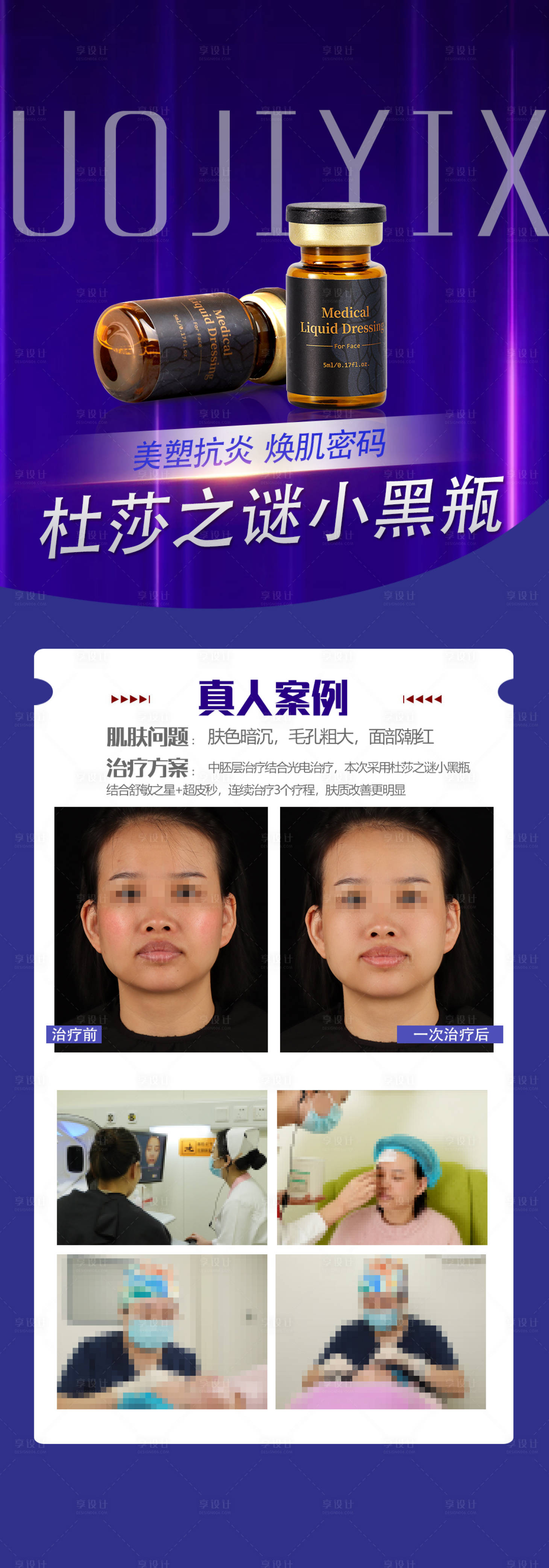 源文件下載【享設(shè)計(jì)】搜索編號：77460008649435444【醫(yī)美   】