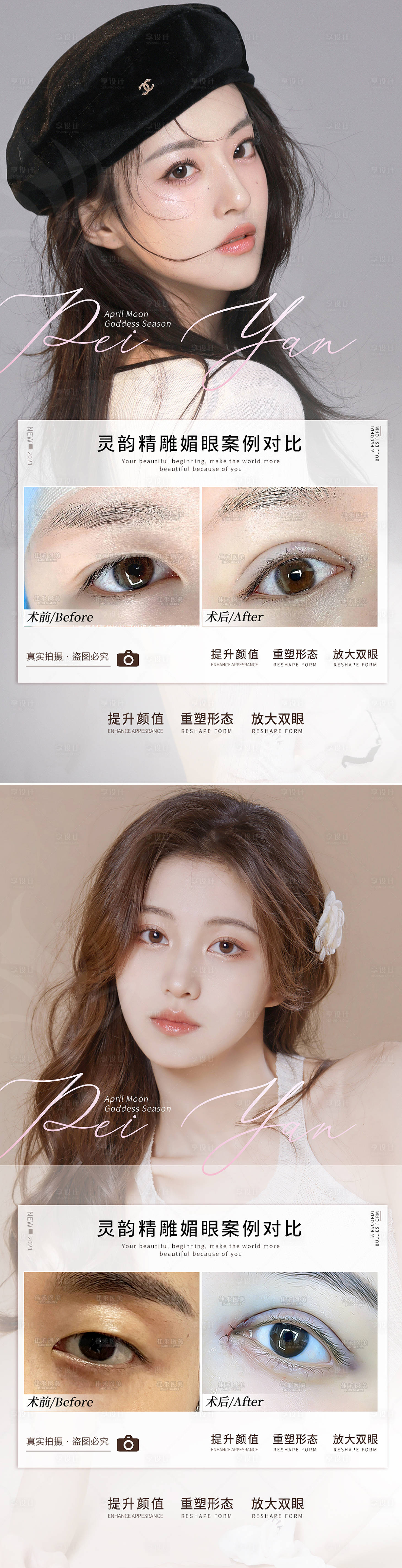 源文件下載【享設(shè)計(jì)】搜索編號：39450008494293374【醫(yī)美雙眼皮案例對比海報(bào)】