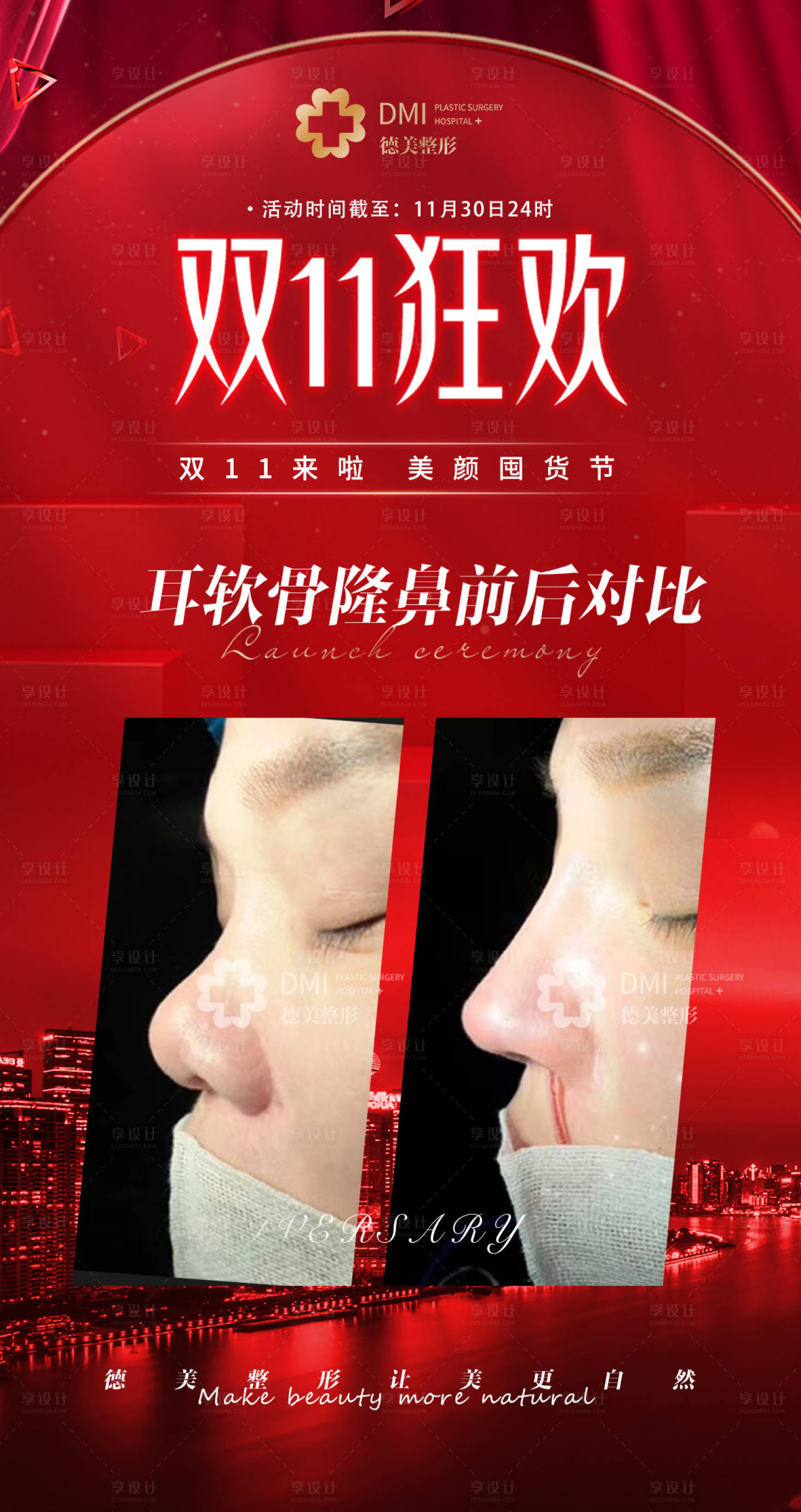 源文件下载【隆鼻对比图】编号：87320008466536224