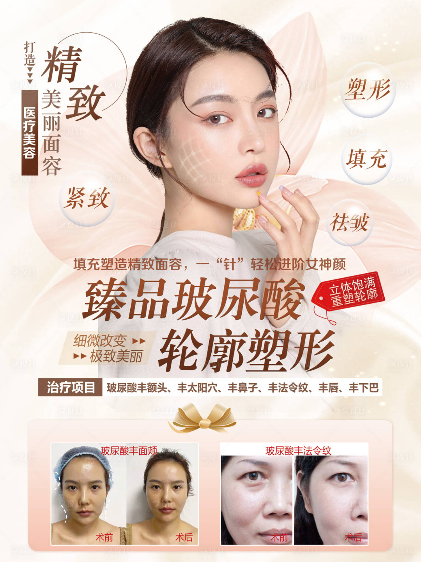 源文件下載【享設(shè)計】搜索編號：65420008475221476【醫(yī)美玻尿酸海報】