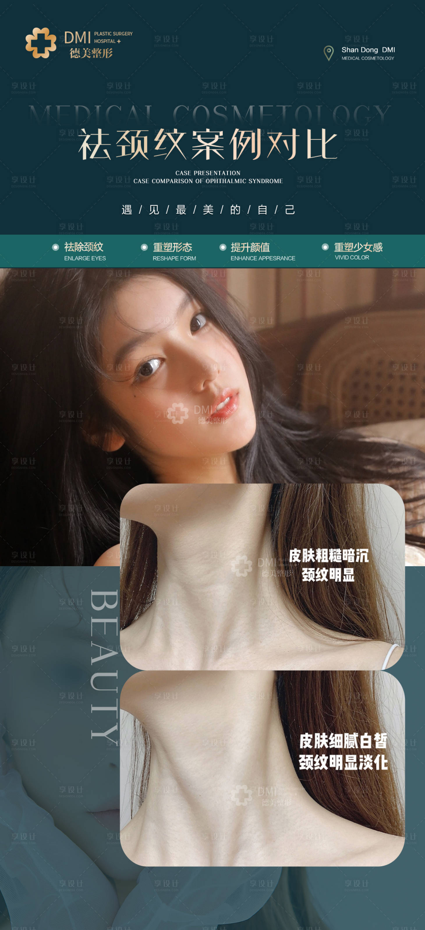 源文件下载【享设计】搜索编号：55910008466467344【祛颈纹整形对比海报】