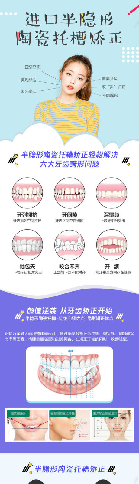 源文件下载【进口半隐形陶瓷托槽矫正长图海报】编号：20220218113039151