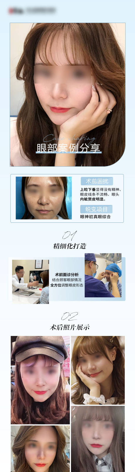 源文件下载【医美双眼皮对比案例海报】编号：29900008596141865