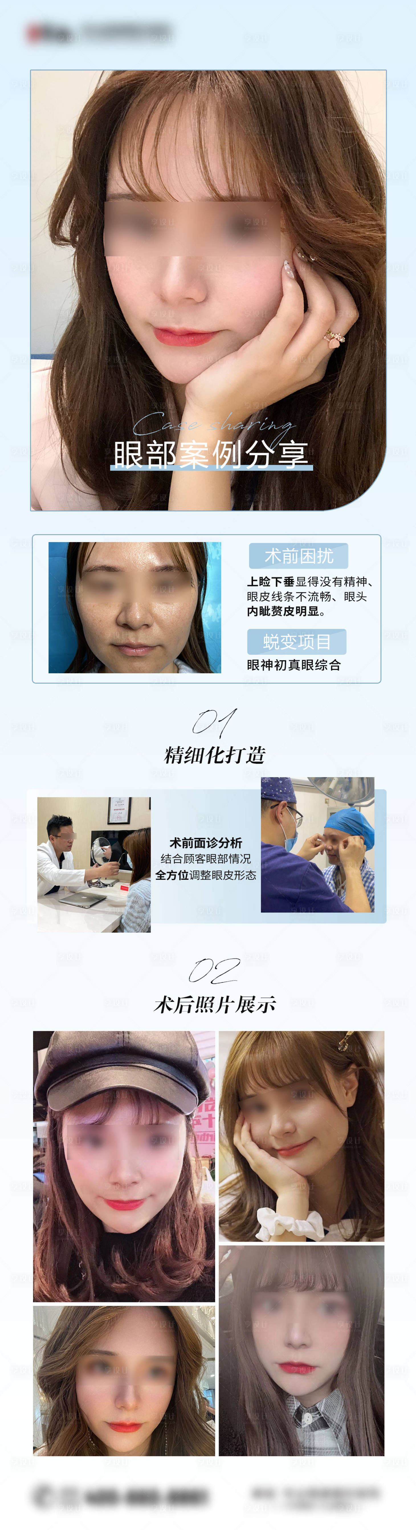 源文件下载【享设计】搜索编号：29900008596141865【医美双眼皮对比案例海报】