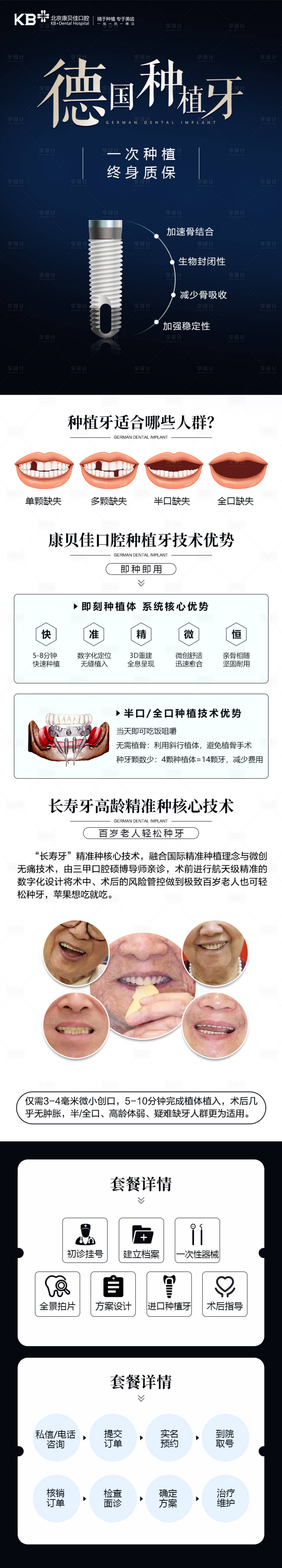 源文件下載【德國種植牙長圖】編號：32290008478575704