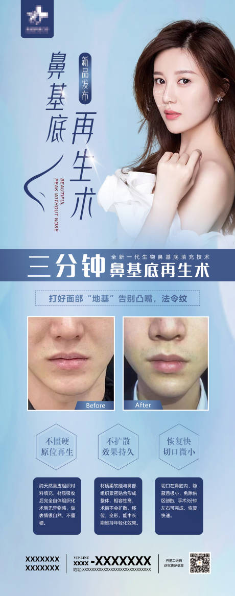鼻基底再生术