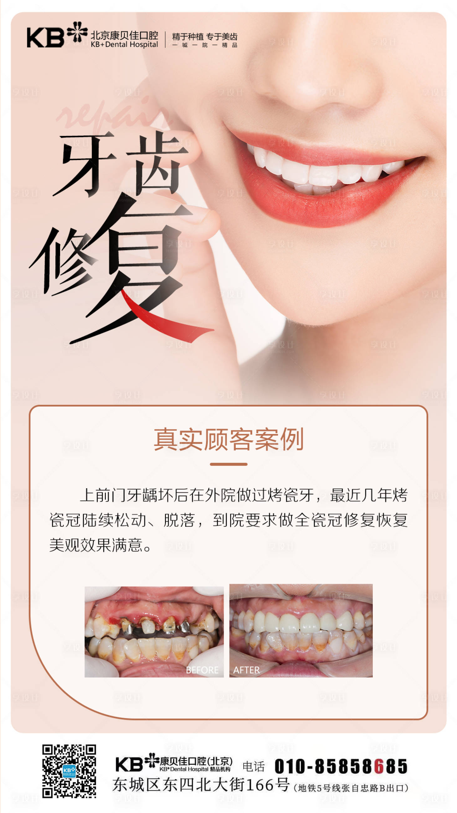 源文件下載【享設計】搜索編號：16330008626137149【牙齒修復案例海報】