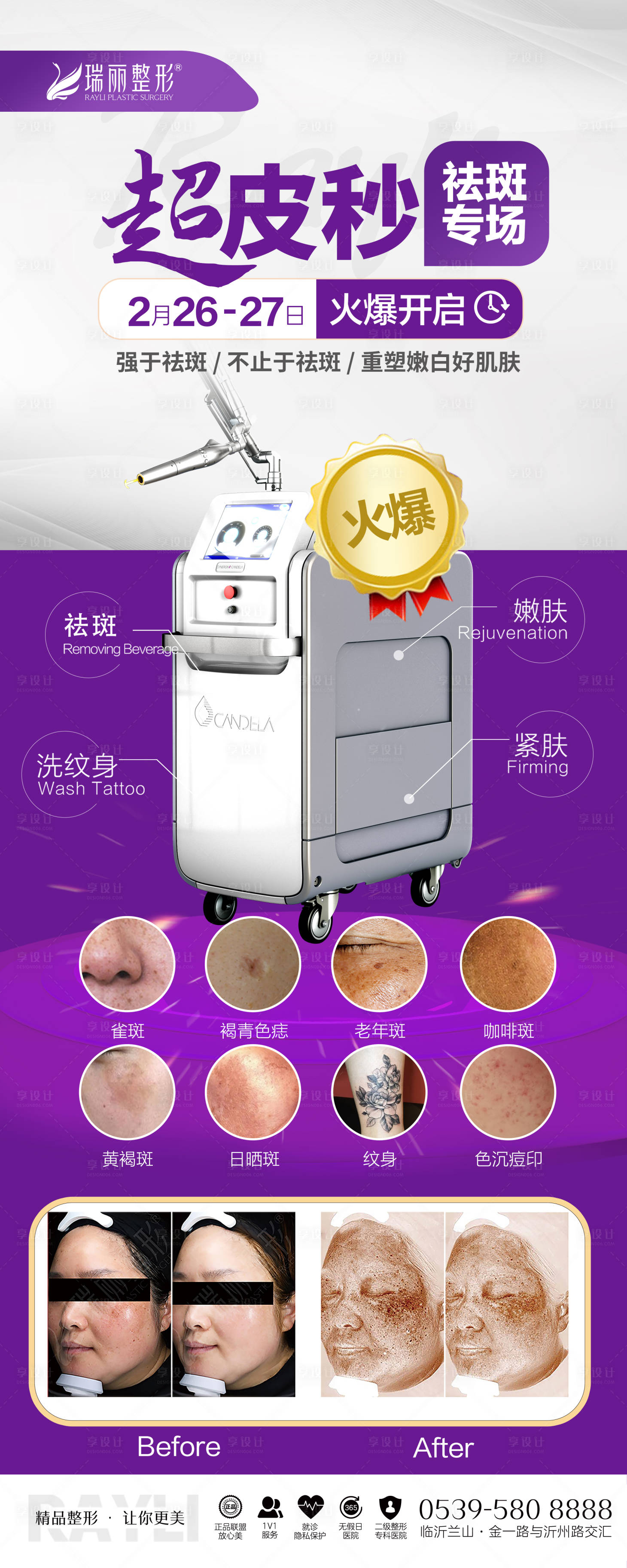 源文件下載【享設計】搜索編號：64070008503237071【醫美超皮秒長圖 】