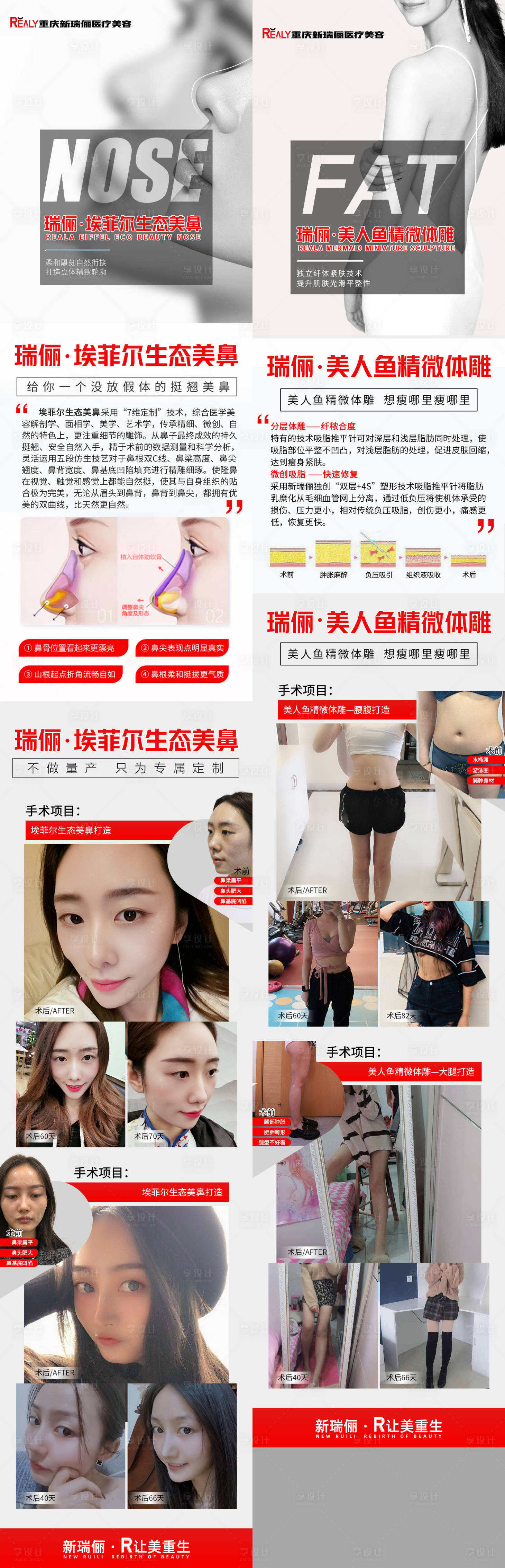 源文件下载【医美整形案例长图海报】编号：73340008625953643