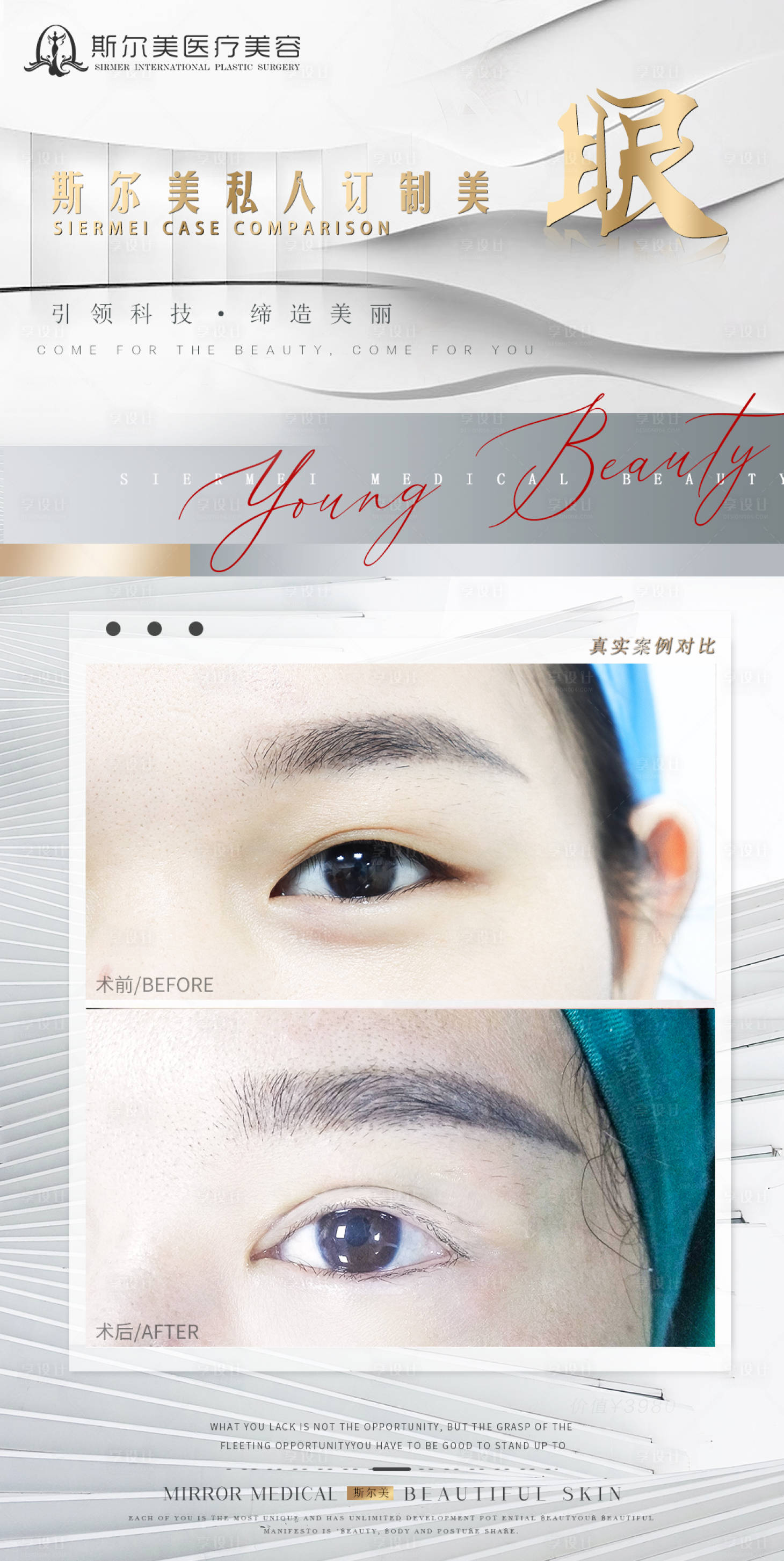 源文件下載【享設(shè)計(jì)】搜索編號(hào)：95330008581776803【醫(yī)美案例海報(bào)】