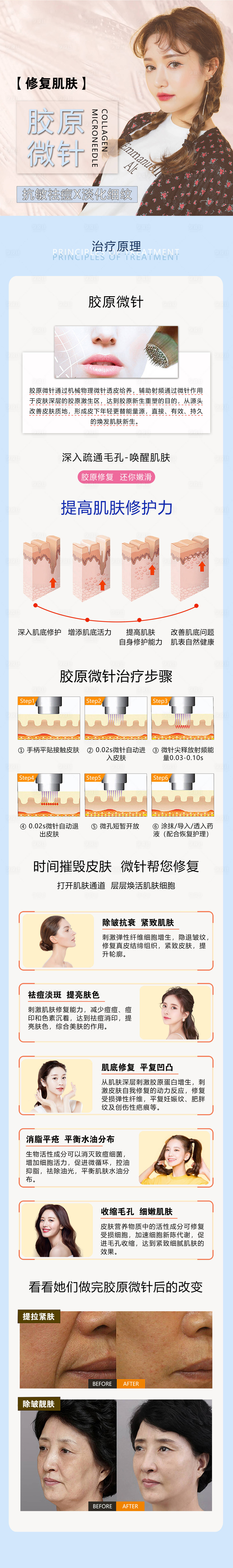 源文件下載【享設計】搜索編號：12160008498639546【醫美膠原微針詳情頁】