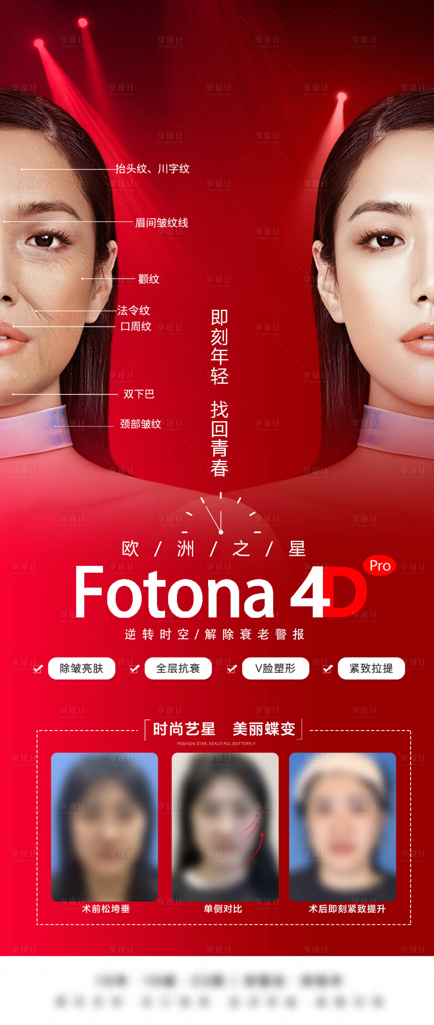 源文件下載【醫美美容F4Fotona4D 】編號：42750008349694129