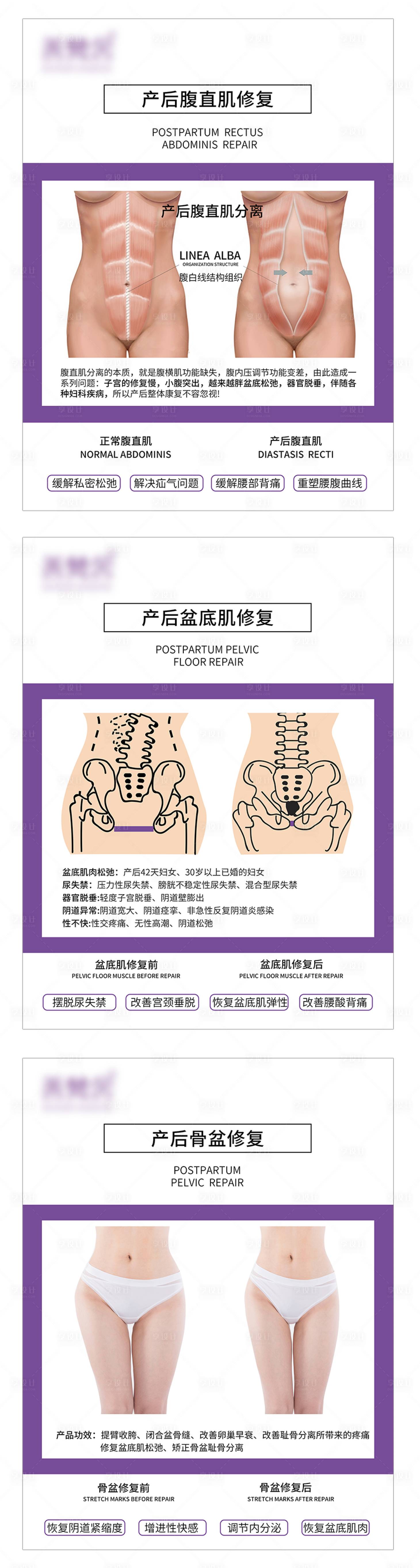 源文件下载【产后系列对比图海报】编号：17590008558293668