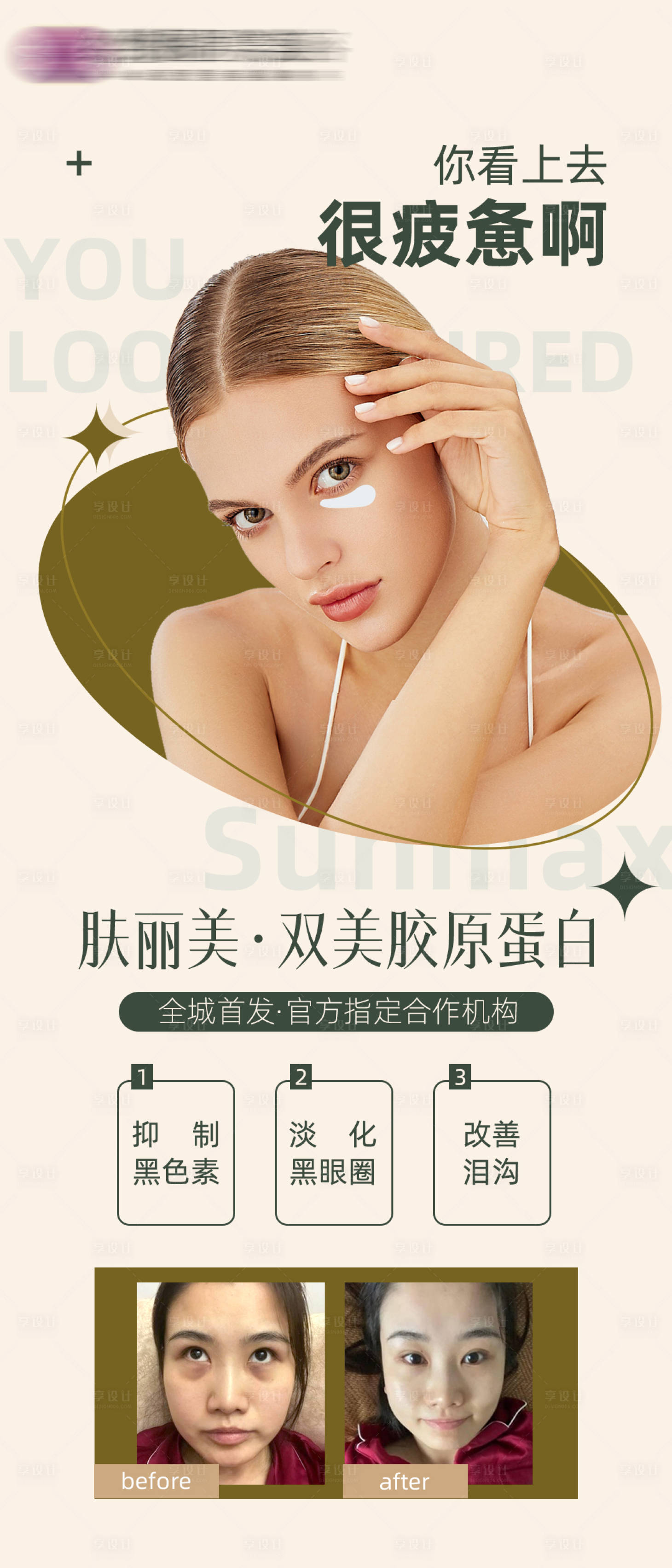 源文件下载【享设计】搜索编号：90960008531345024【医美胶原蛋白祛黑眼圈海报】