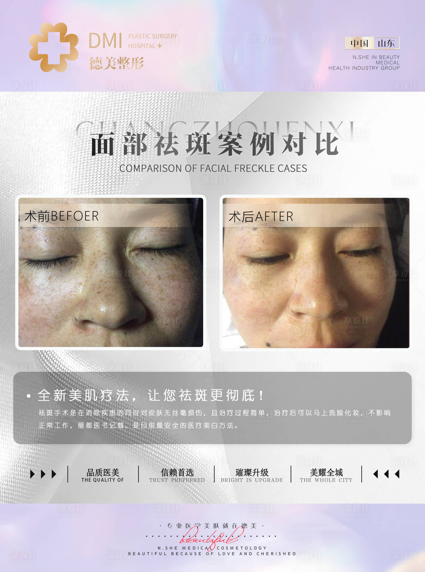 源文件下载【享设计】搜索编号：67430008444935026【双眼皮祛斑医美案例对比海报】