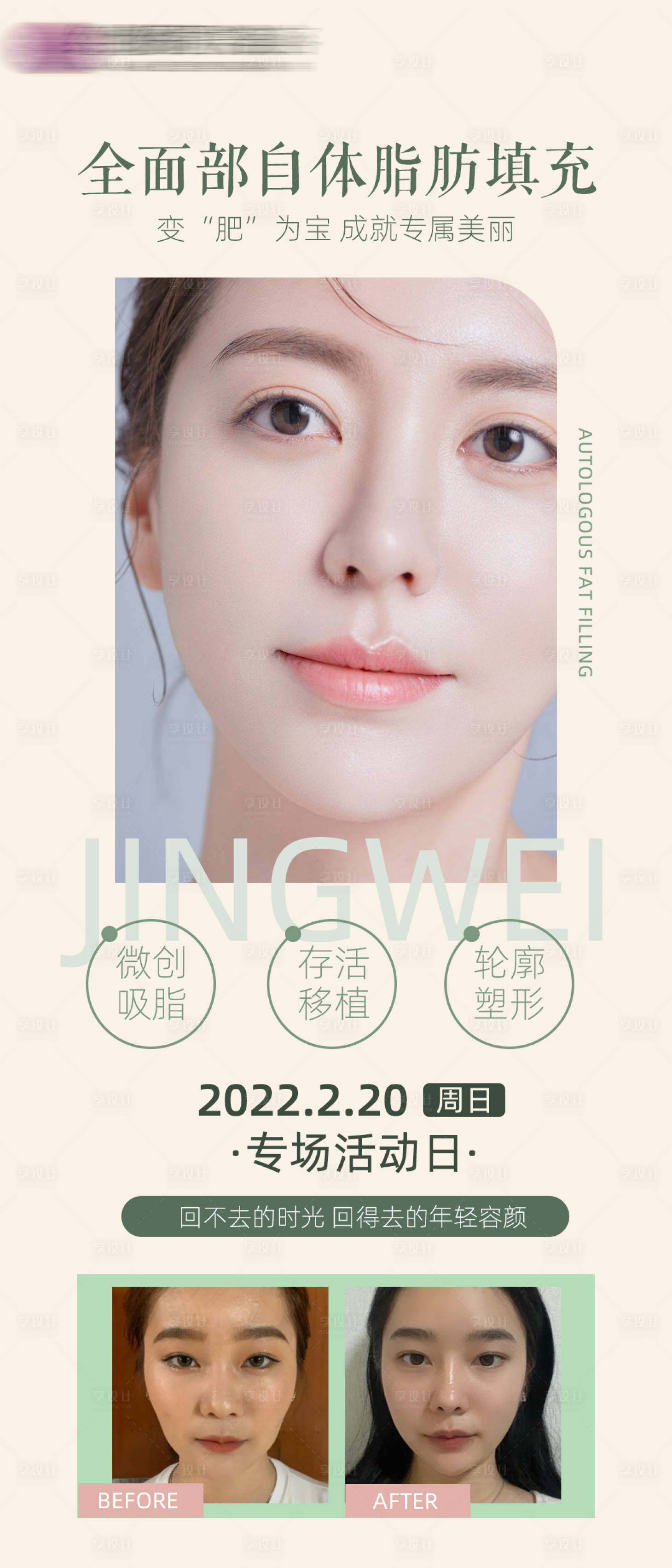 源文件下载【享设计】搜索编号：65040008498841173【医美自体脂肪海报】