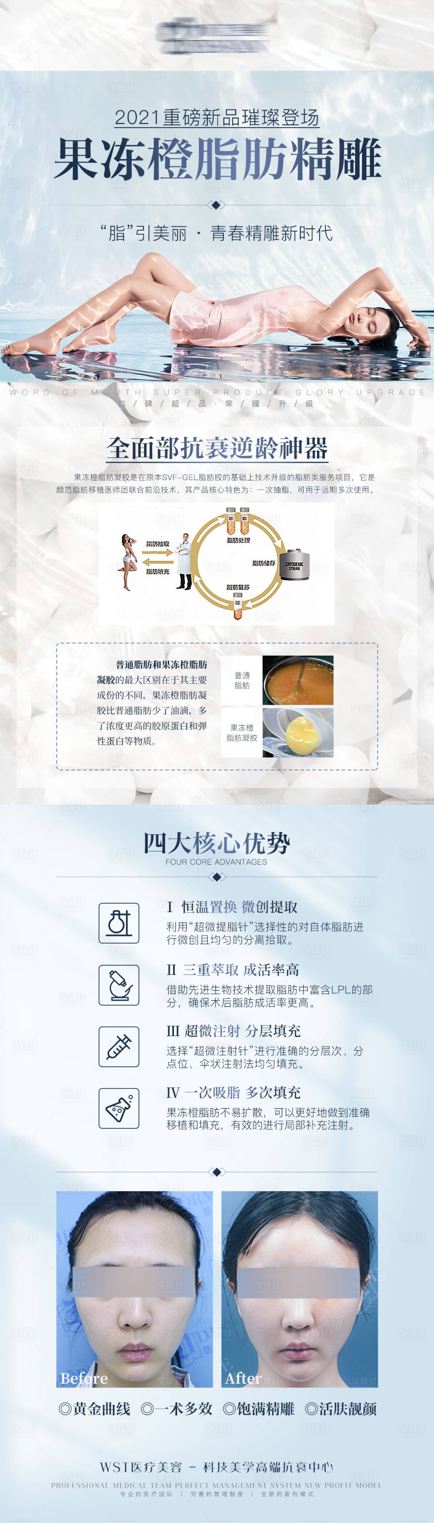 源文件下载【医美脂肪精雕项目宣传】编号：18040008585586793