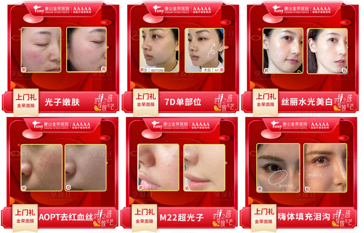 源文件下载【轻填充六宫格】编号：52920008549347065
