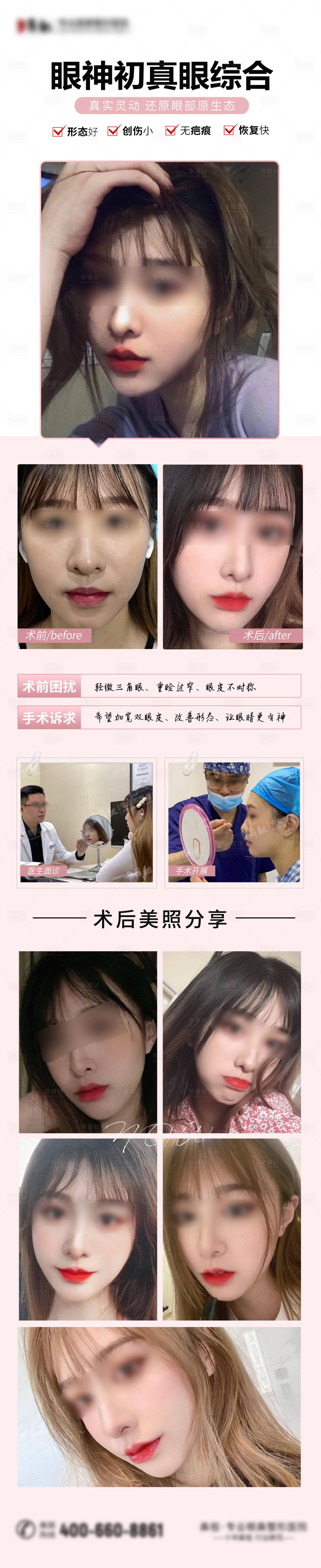 源文件下载【享设计】搜索编号：14740008485683307【医美双眼皮对比长图海报】