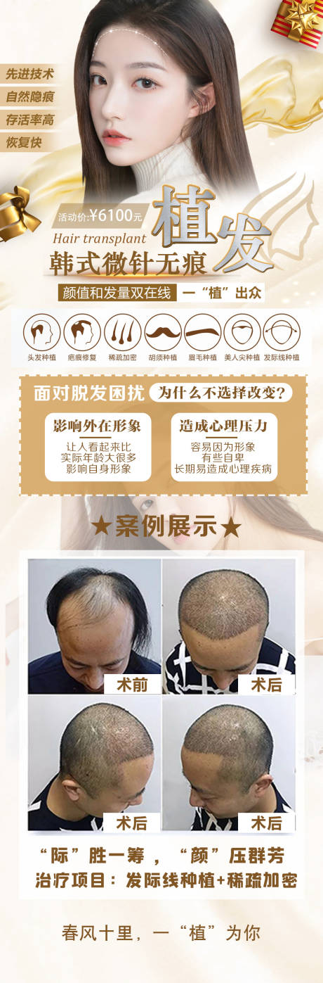 源文件下载【医美植发活动长图海报】编号：20320008526153727