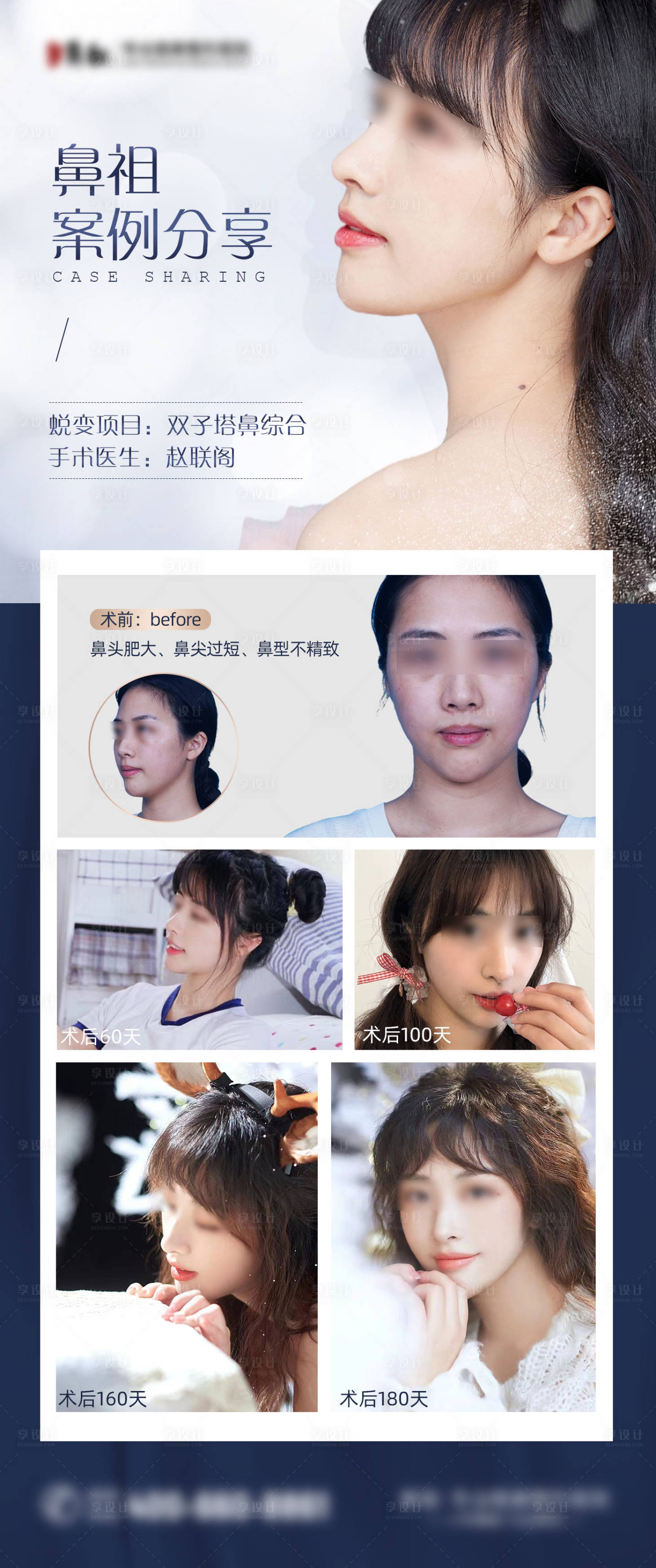 源文件下載【享設計】搜索編號：10350008565128673【醫美鼻子對比海報】