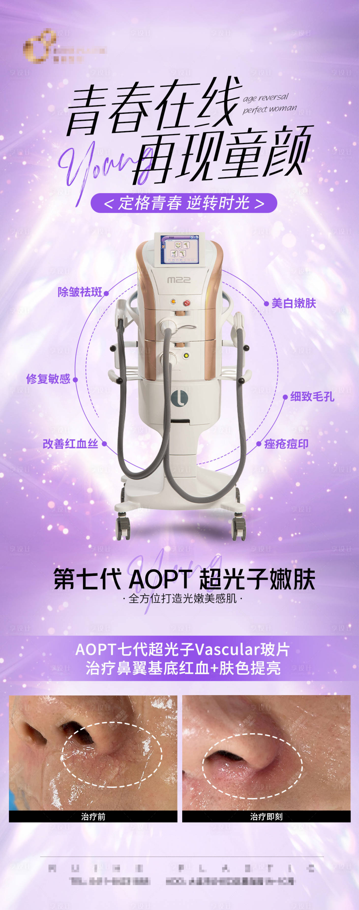源文件下載【享設(shè)計(jì)】搜索編號：64840008544334665【醫(yī)美儀器效果對比】
