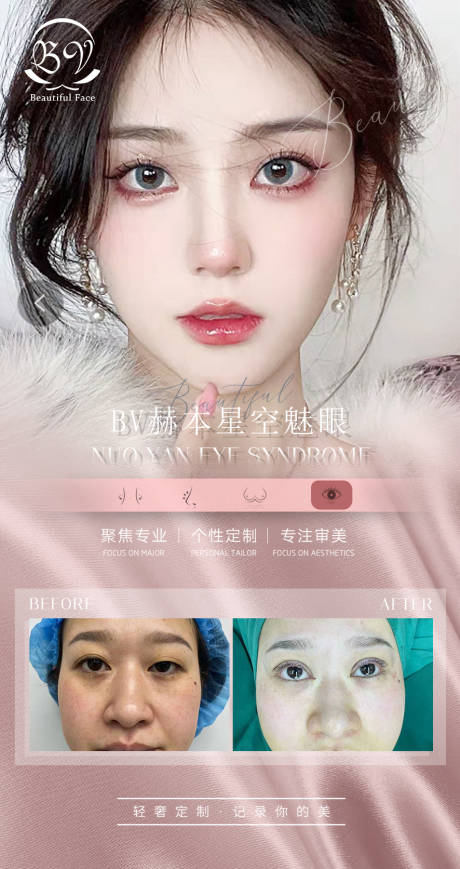 源文件下载【医美眼综合案例海报】编号：58860008646141961