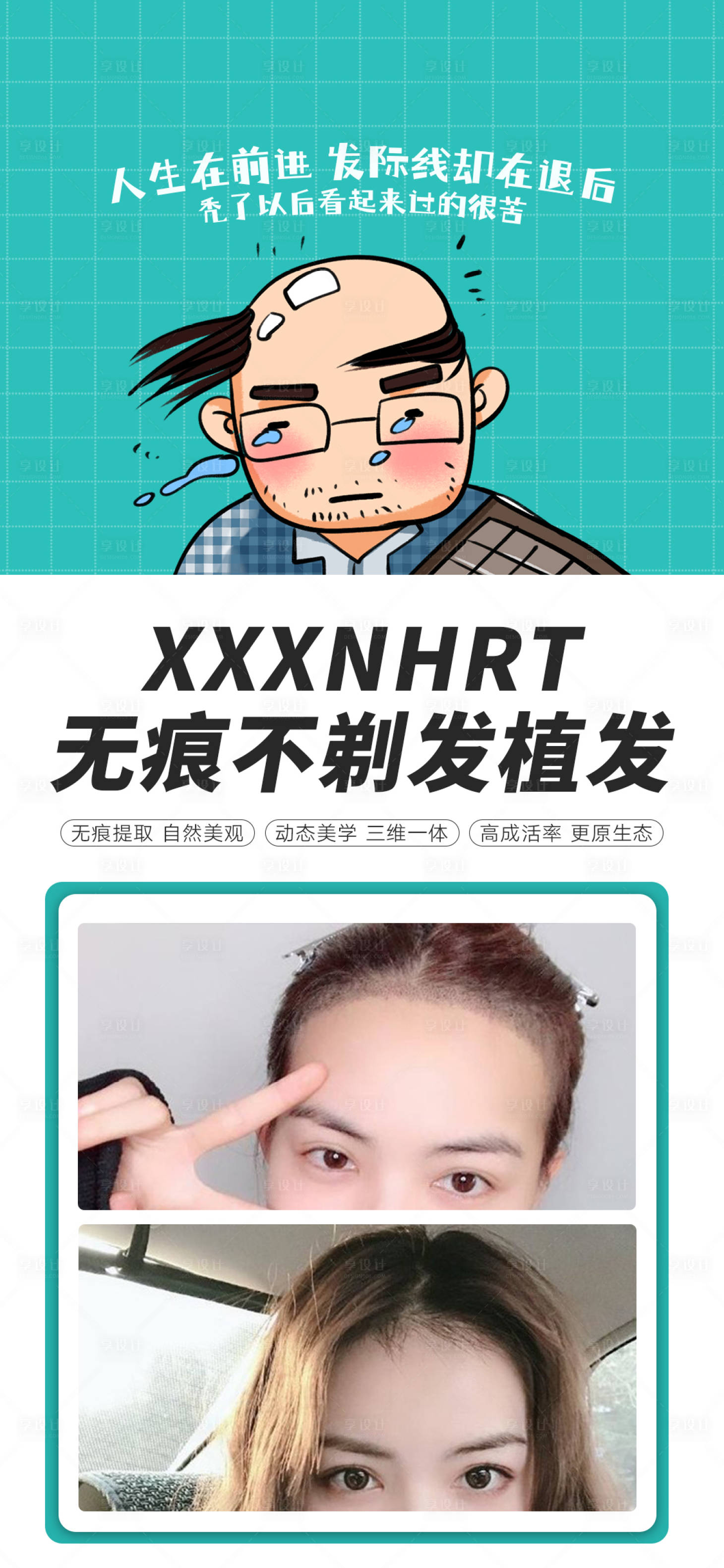 源文件下载【医美植发朋友圈海报】编号：56820008464014041