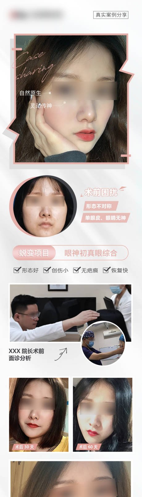 源文件下载【医美双眼皮案例长图】编号：52720008596597481