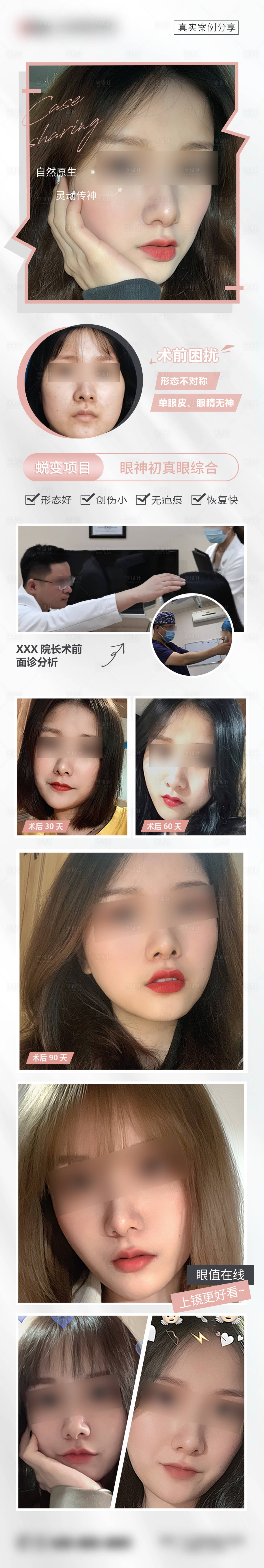 源文件下载【享设计】搜索编号：52720008596597481【医美双眼皮案例长图】