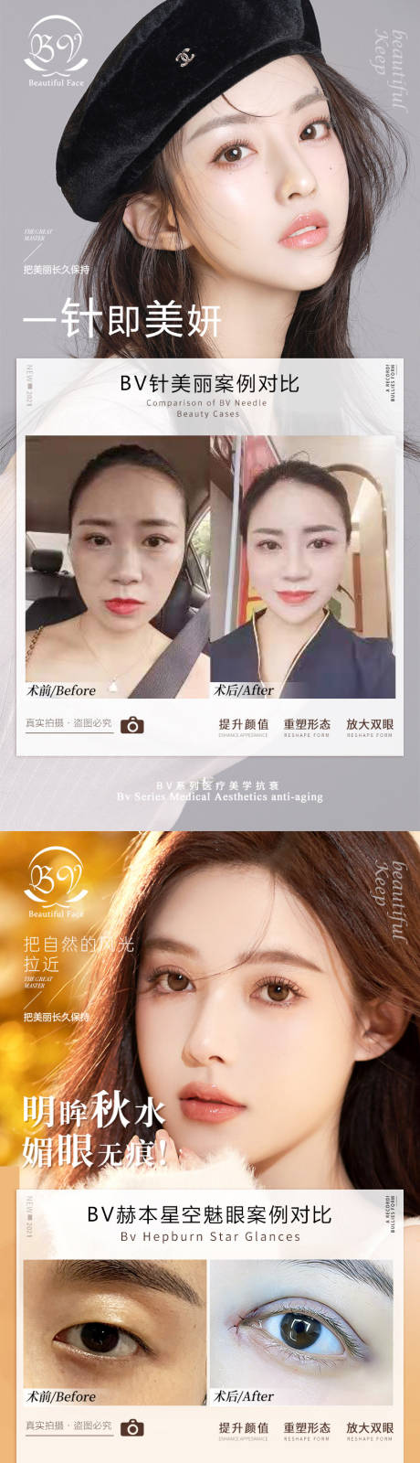 源文件下载【医美案例系列海报】编号：14180008383523522