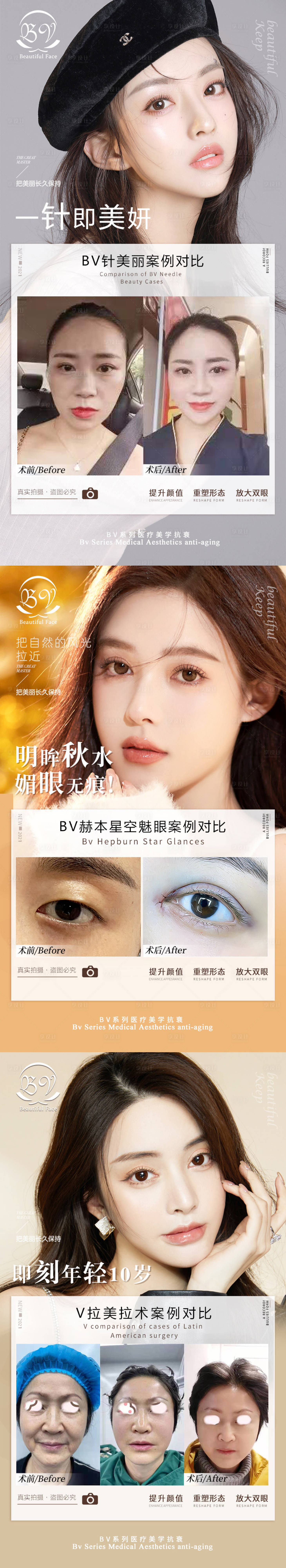 源文件下载【享设计】搜索编号：14180008383523522【医美案例系列海报】