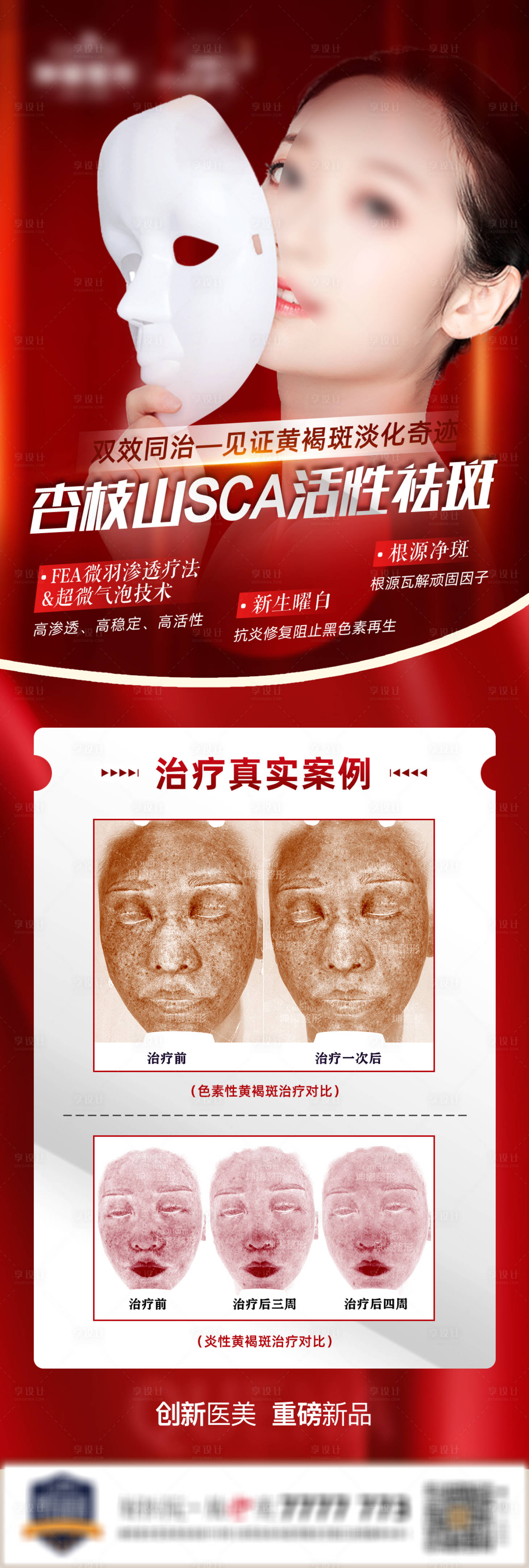 源文件下載【享設計】搜索編號：32820008316329925【醫美杏枝山祛斑長圖海報】
