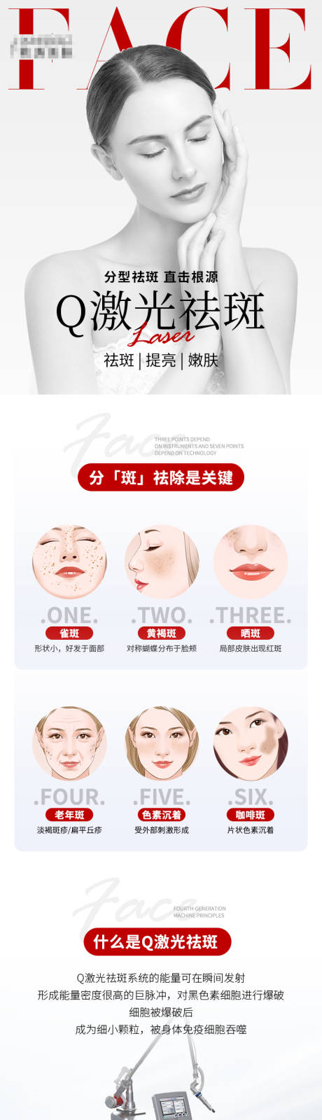 源文件下载【激光祛斑仪器医美详情页】编号：35720008527231184