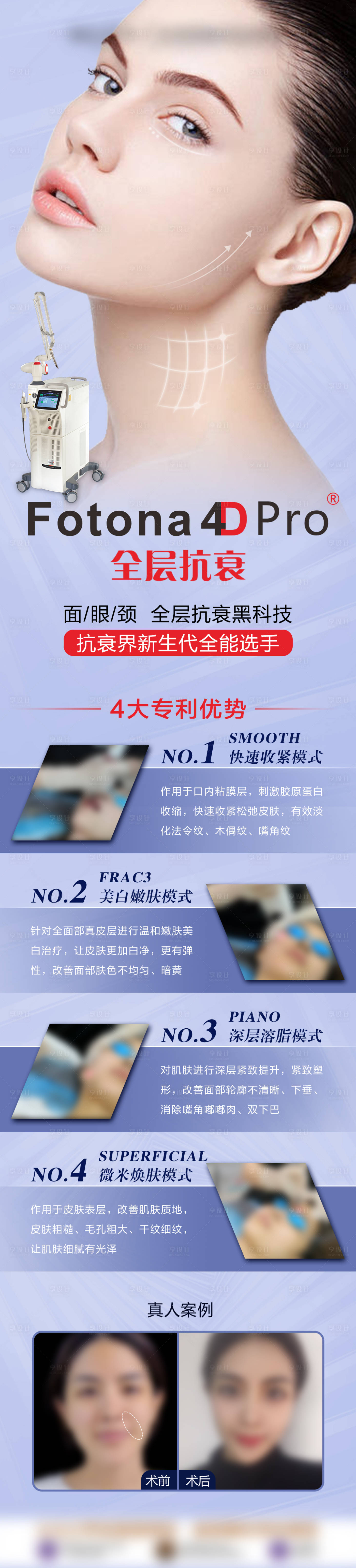 源文件下載【享設計】搜索編號：21860009031476078【Fotona 4D Pro】