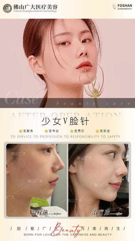 源文件下载【少女V脸针案例】编号：72980008900494445