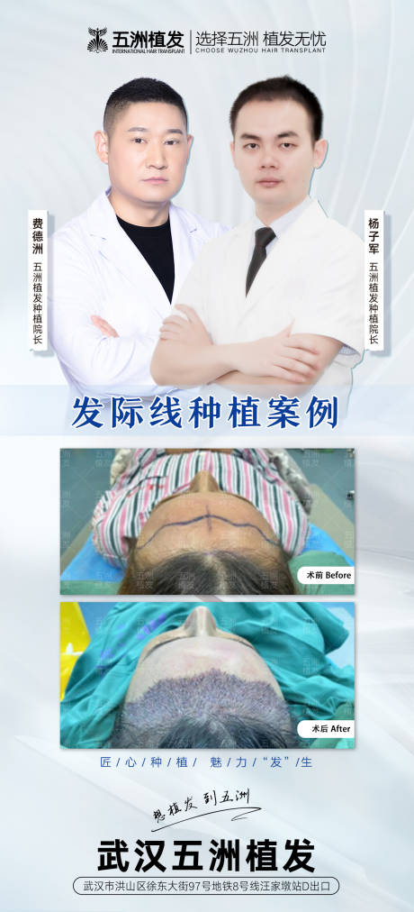 源文件下载【植发专家案例海报】编号：99630009038141204