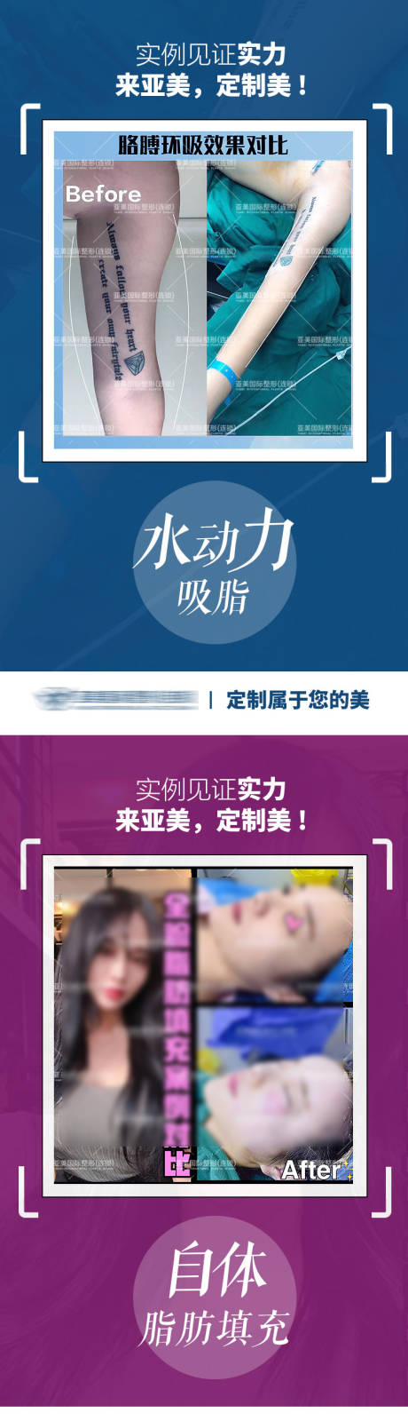 源文件下载【医美整形案例对比系列海报】编号：68340009156179486