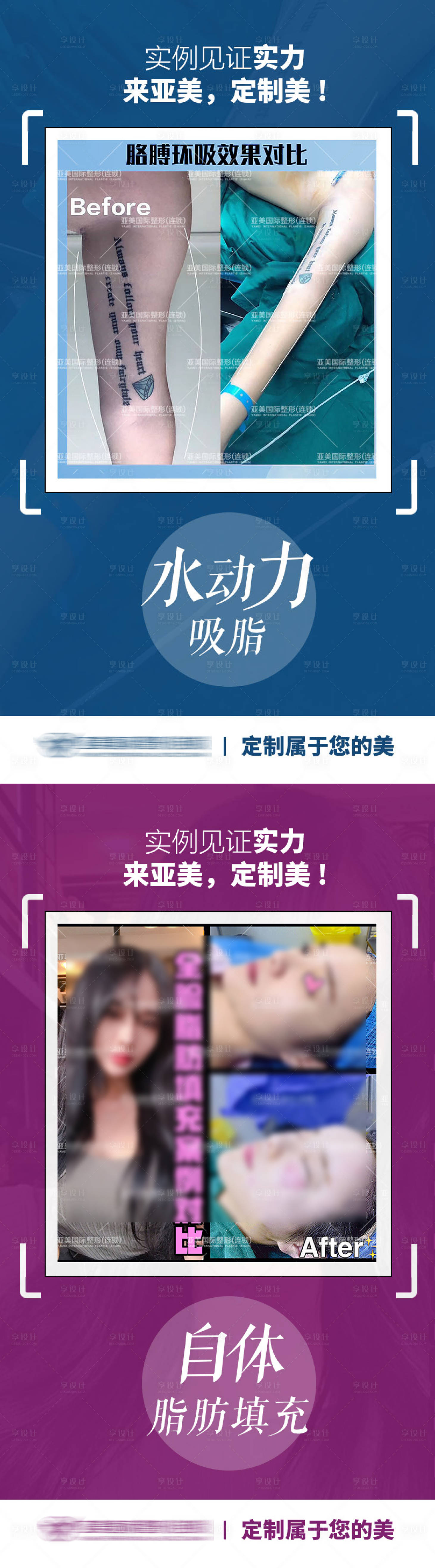 源文件下载【享设计】搜索编号：68340009156179486【医美整形案例对比系列海报】