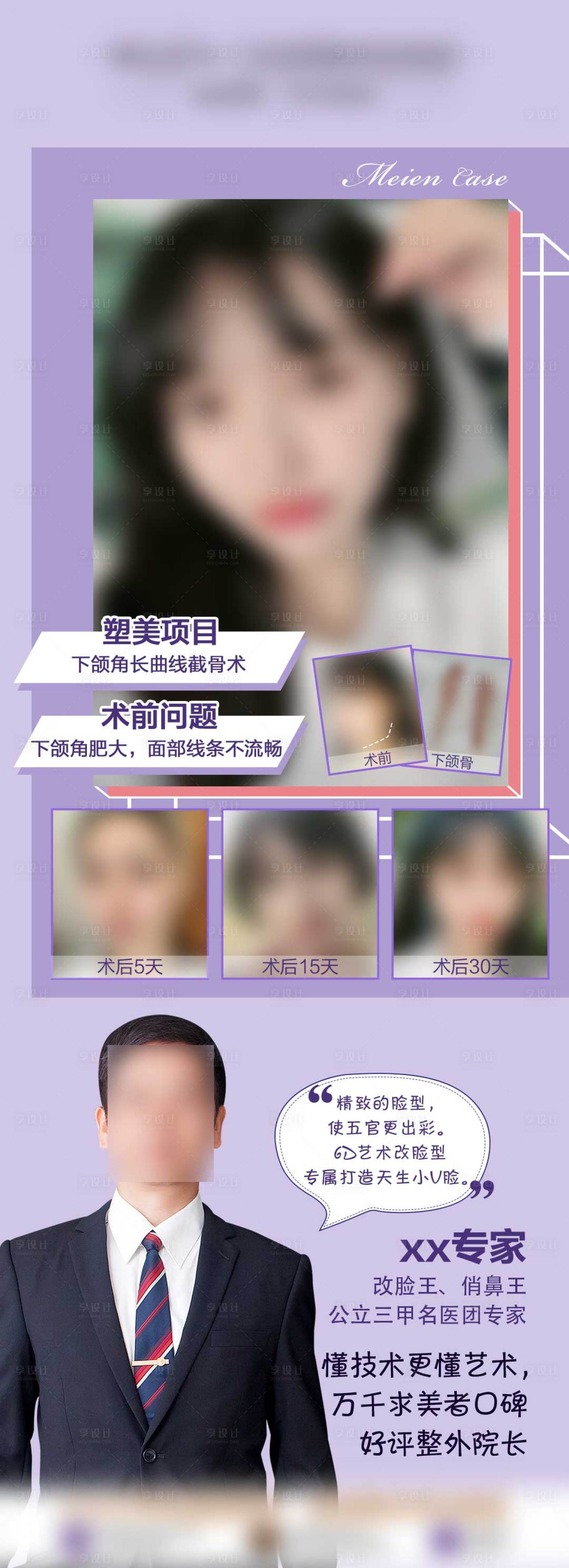 源文件下载【享设计】搜索编号：95520009032338194【医美专家案例长图海报】