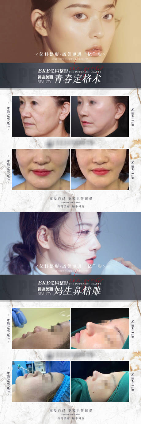 源文件下载【享设计】搜索编号：36180009199239252【医美案例对比海报】