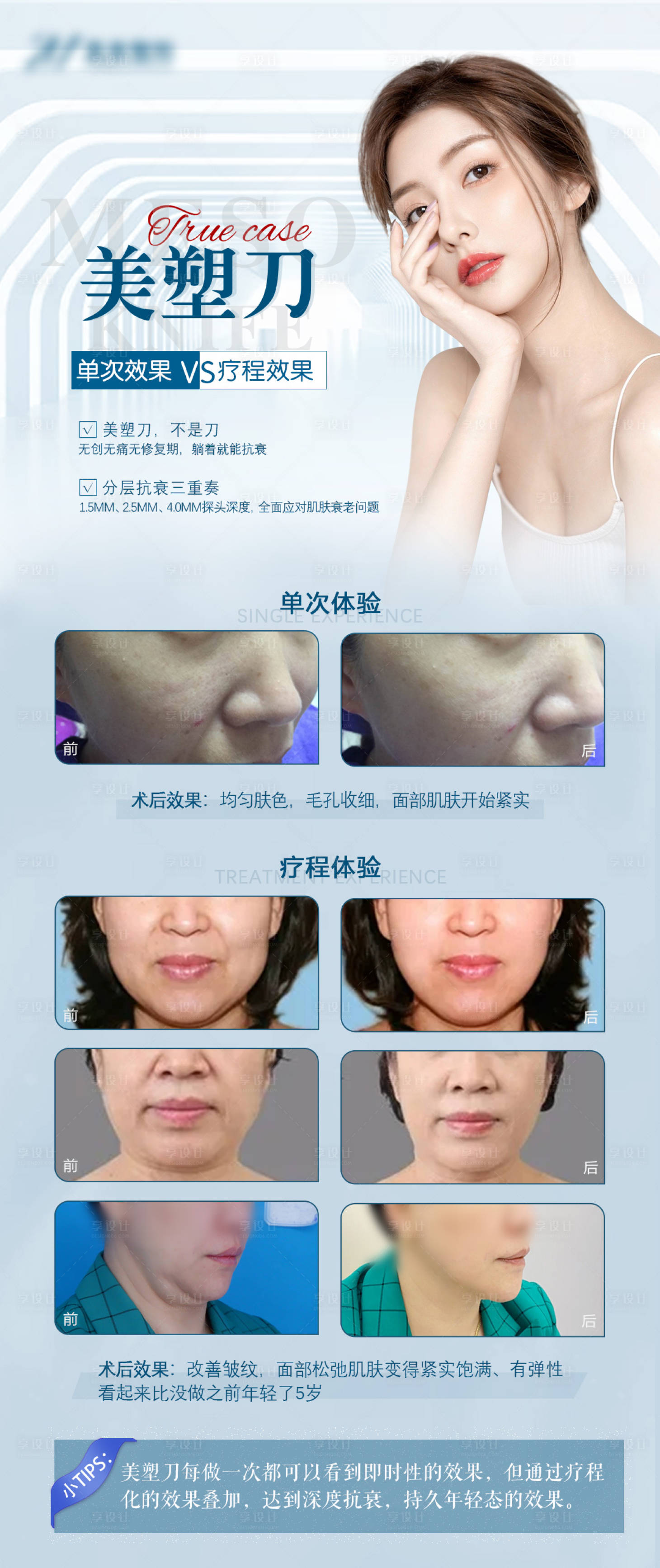 源文件下载【享设计】搜索编号：30750008751195787【医美美塑刀案例展架】