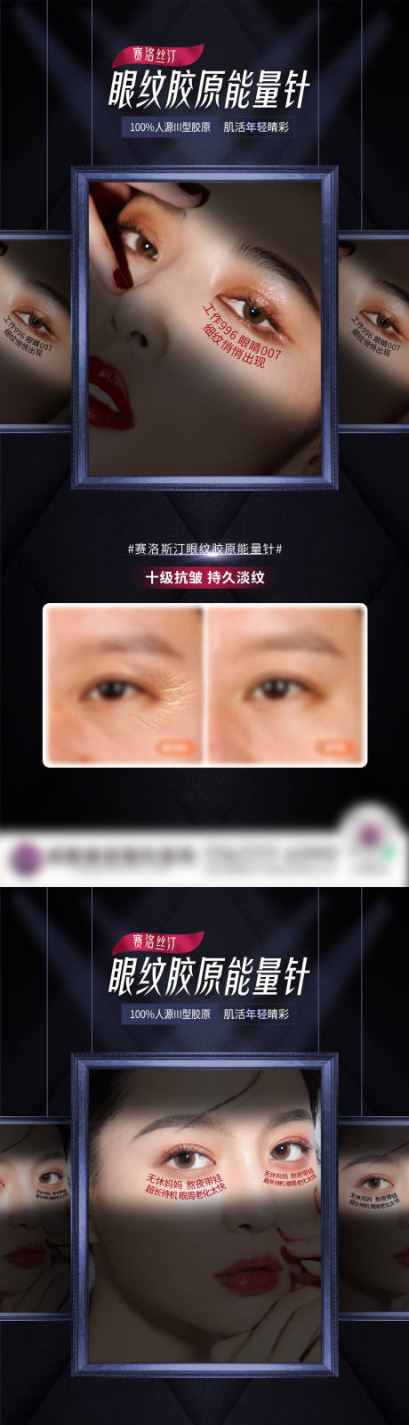 源文件下载【眼纹案例促销医美海报】编号：54790008786046898