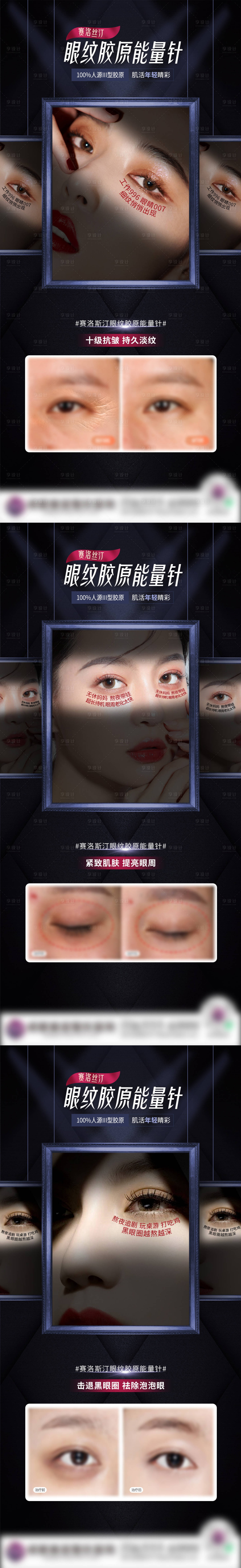 源文件下载【享设计】搜索编号：54790008786046898【眼纹案例促销医美海报】