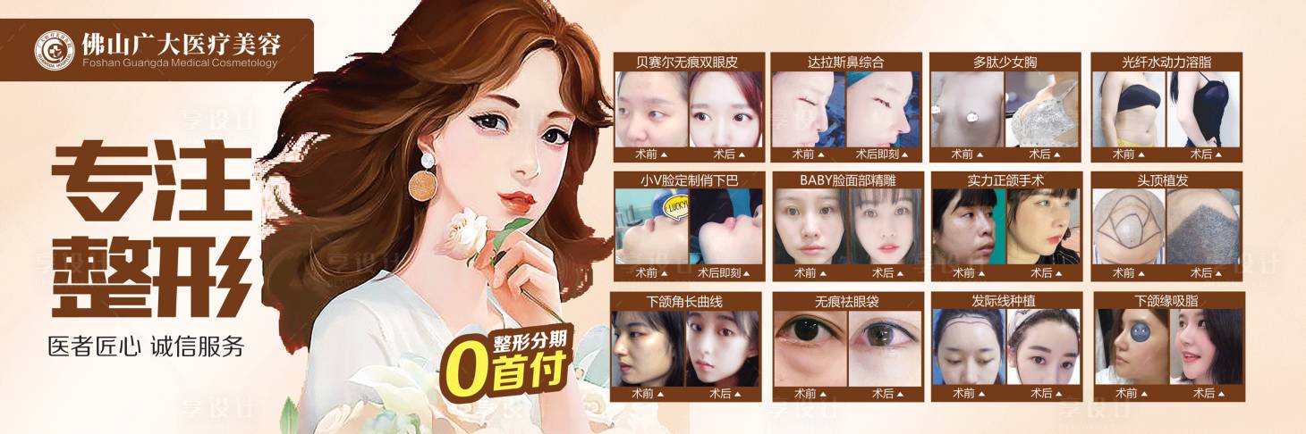 源文件下载【享设计】搜索编号：48150008775748503【医疗案例对比广告展板】