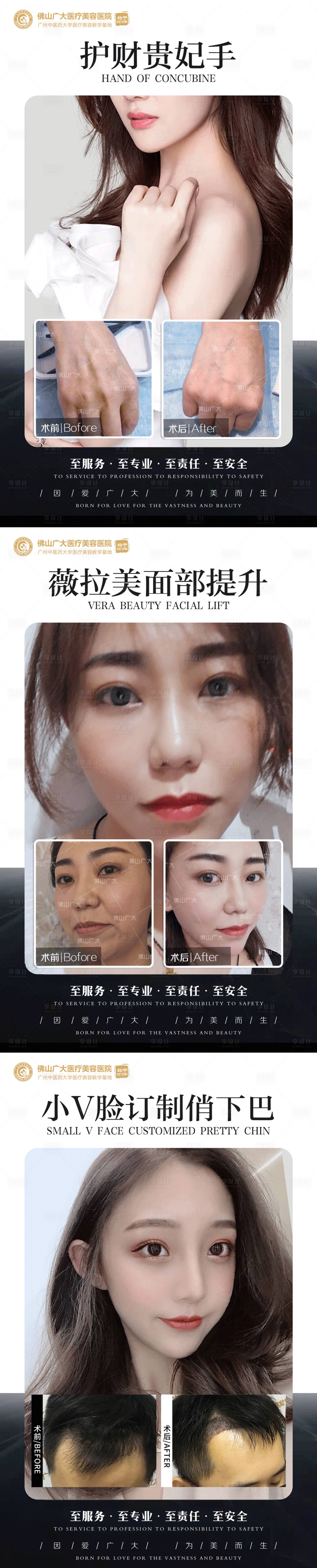 源文件下載【享設(shè)計】搜索編號：80680009016131908【整形真人案例分享集】